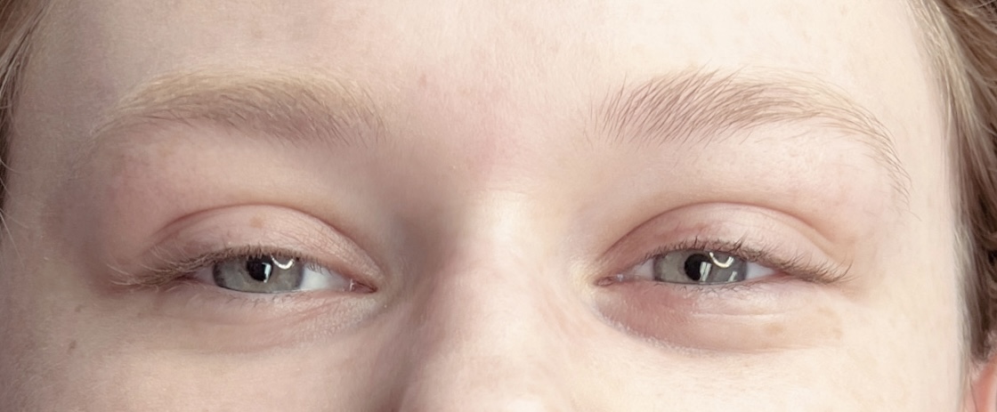 After Lash Lift