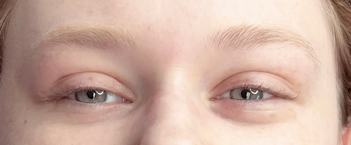 After Lash Lift