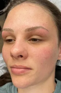 Before Microblading