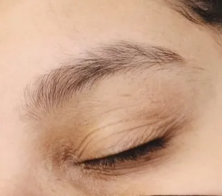 After Threading